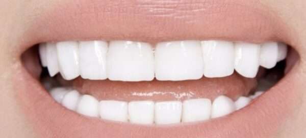 Bio Dental Care Miswak Encías, el tratamiento dental definitivo 100ml. - Imagen 2